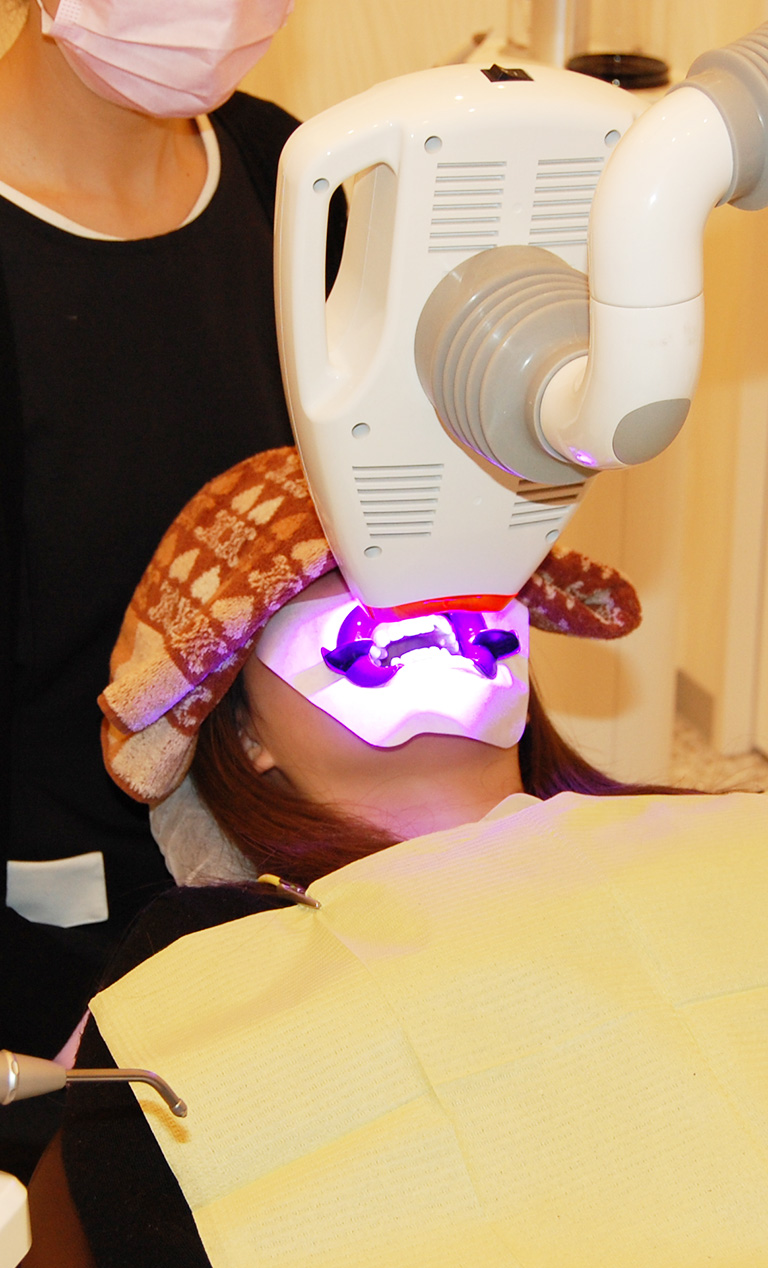 エムズ歯科プラスではGC社コスモブルーを使用したTION®ホワイトニングシステムを導入しております。